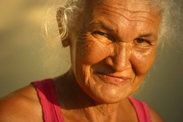 During aging, the skins microbial diversity increases